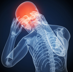 Migraines & Reoccurring Headaches