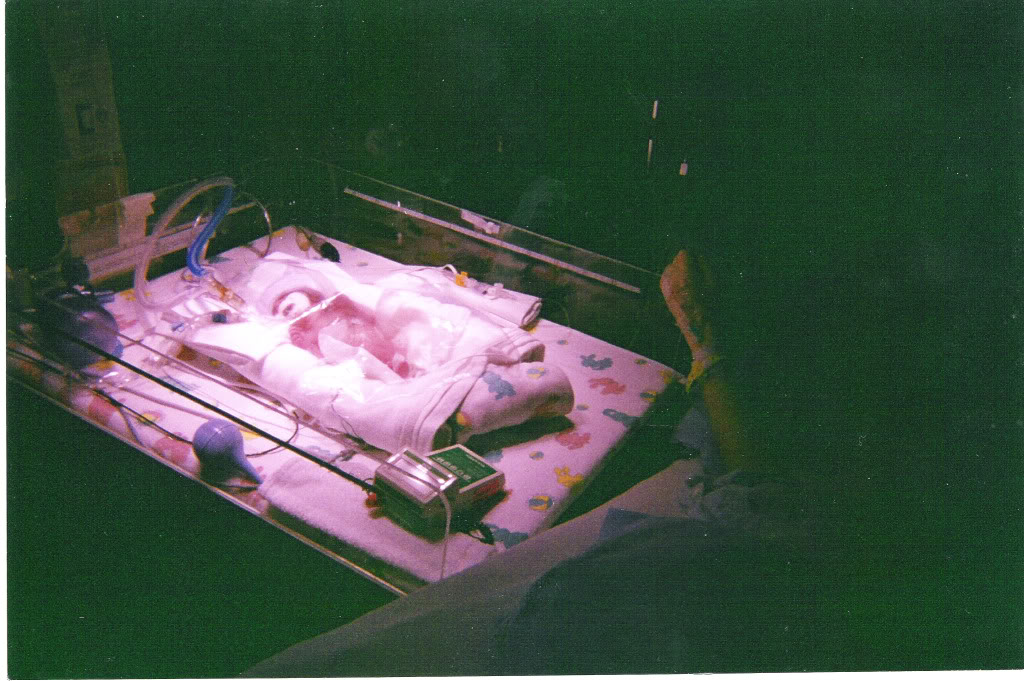 HELLP Syndrome Premature Baby