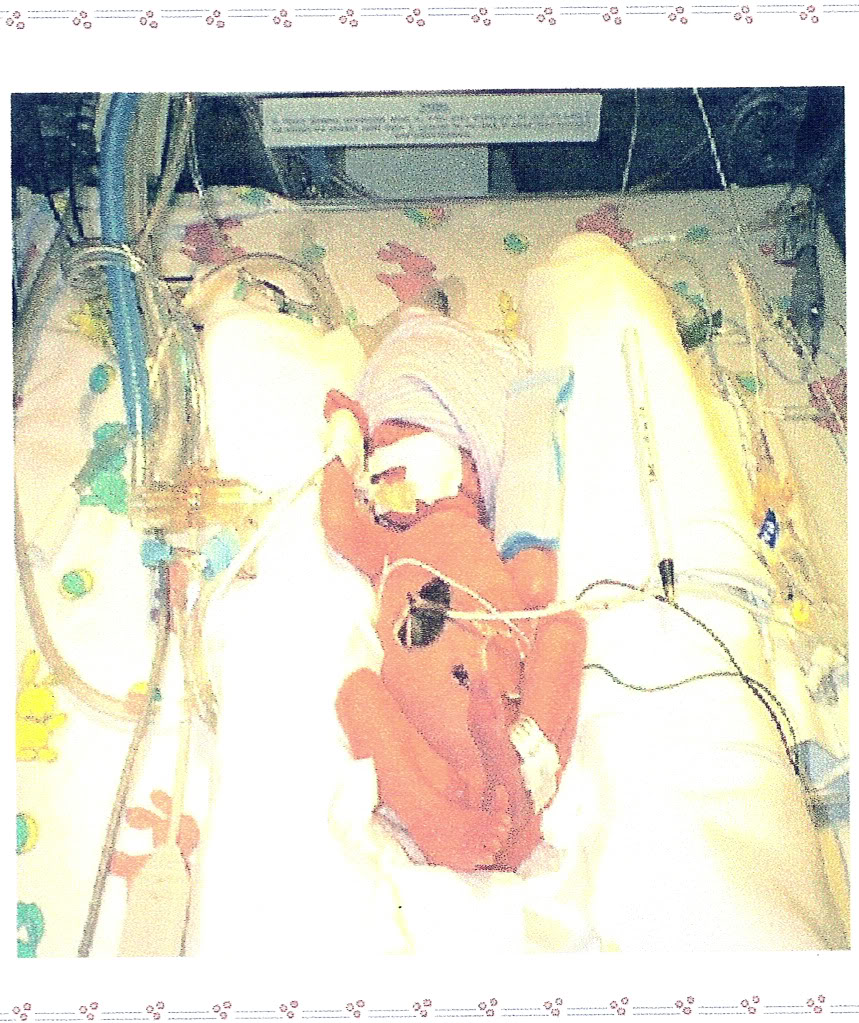 NICU baby born early from pregnancy complications HELLP